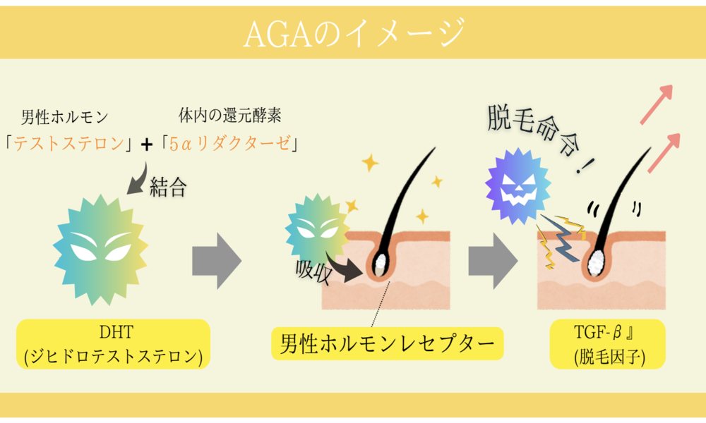 女性の薄毛(​​FAGA)とは？AGAとの違いも解説