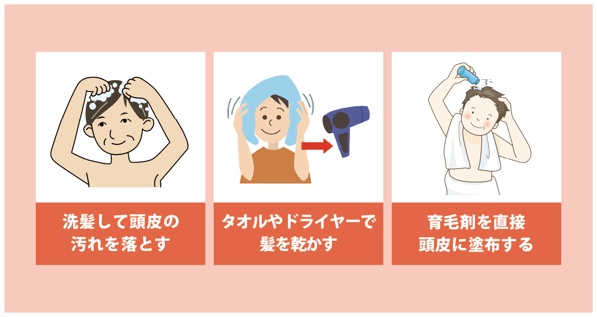 育毛剤の正しい使い方とは？