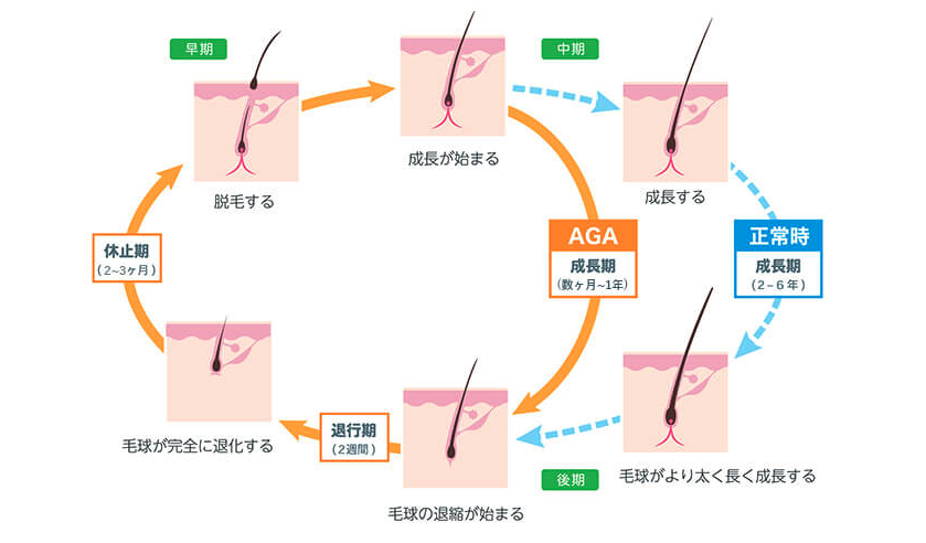 ヘアサイクル（毛周期）