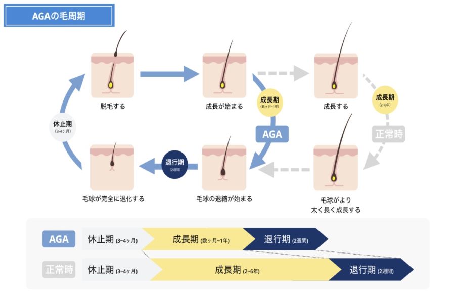 ヘアサイクル（毛周期）