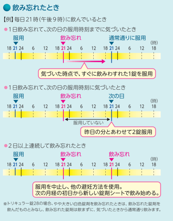 トリキュラー