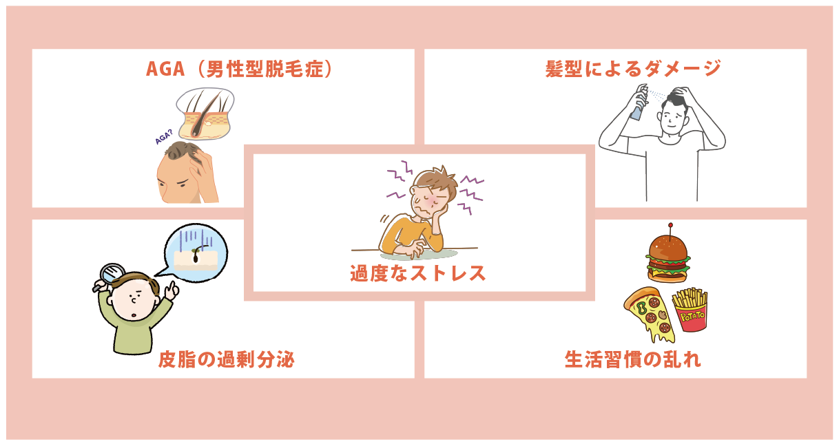 生え際が後退する5つの原因