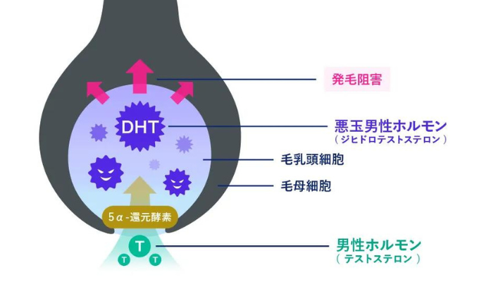 DHT（ジヒドロテストステロン）の増加