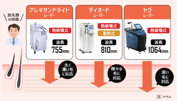 医療脱毛に使用される３種類のレーザー