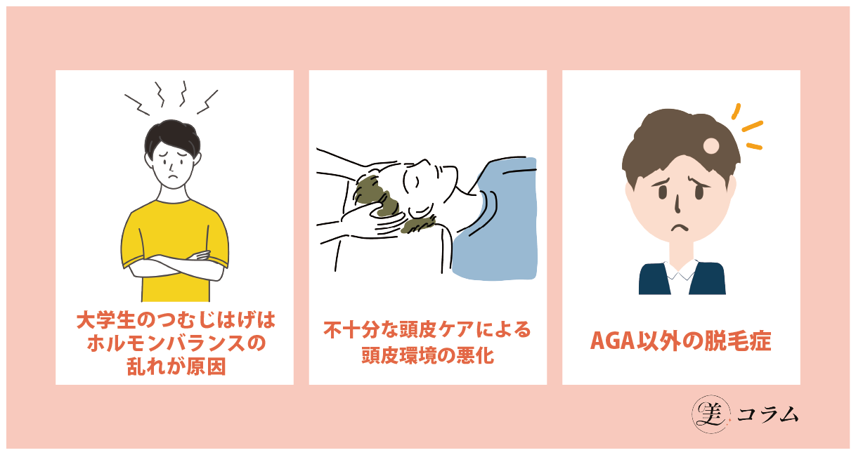 大学生がAGA以外で薄毛になるケース